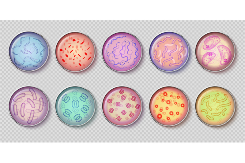 bacteriology-gram-negative-bacteria-culture-and-penicillin-moss-in-pet