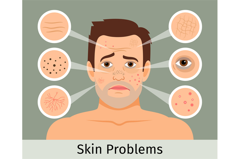 male-facial-skin-problems