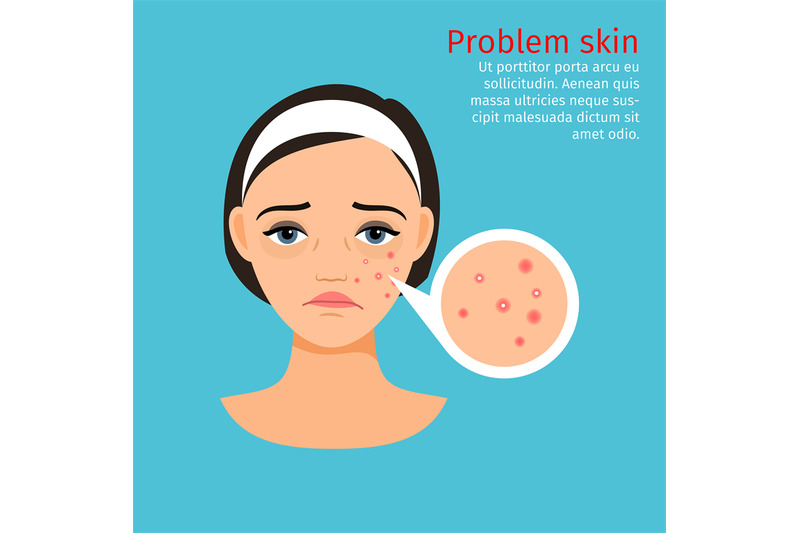 woman-face-problem-skin-with-acne