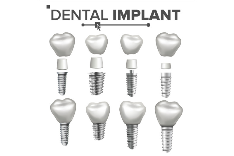 dental-implant-set-vector-dental-clinic-stomatology-flyer-health-tooth-implant-realistic-isolated-illustration