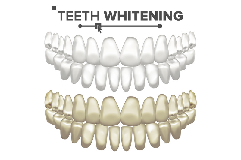 teeth-whitening-vector-dental-care-cleaning-professional-teeth-realistic-isolated-illustration