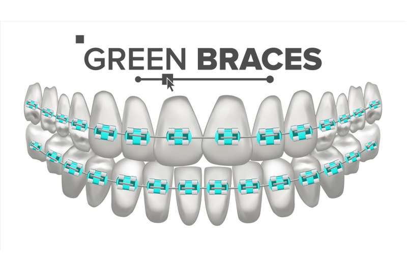 green-child-braces-vector-tooth-and-dental-braces-human-jaw-3d-realistic-isolated-illustration