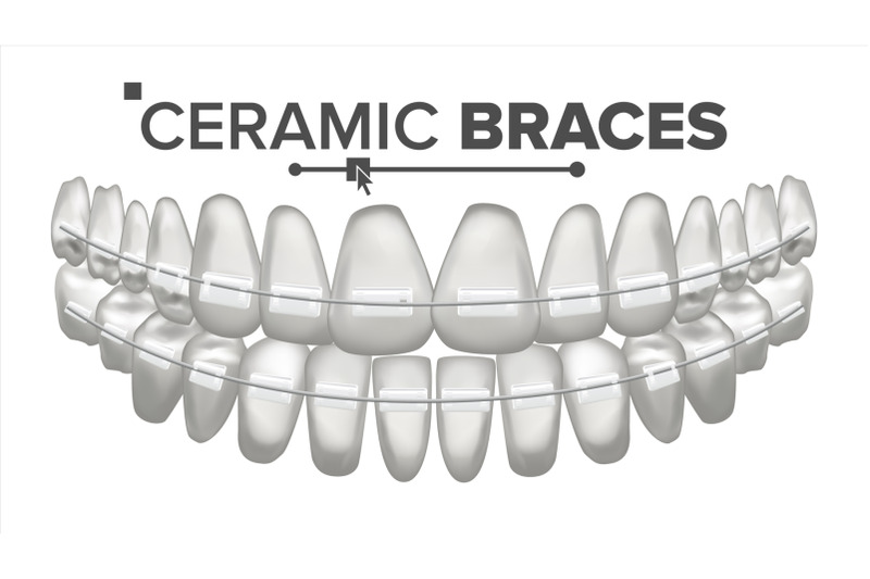 ceramic-braces-vector-human-jaw-dentist-orthodontist-poster-element-3d-realistic-isolated-illustration