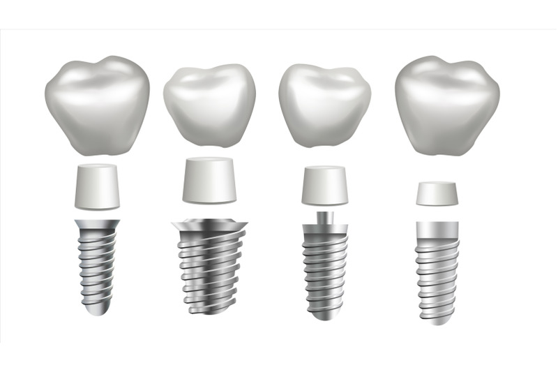 dental-implant-set-vector-tooth-set-dental-health-stomatology-dentistry-whitening-design-realistic-isolated-illustration