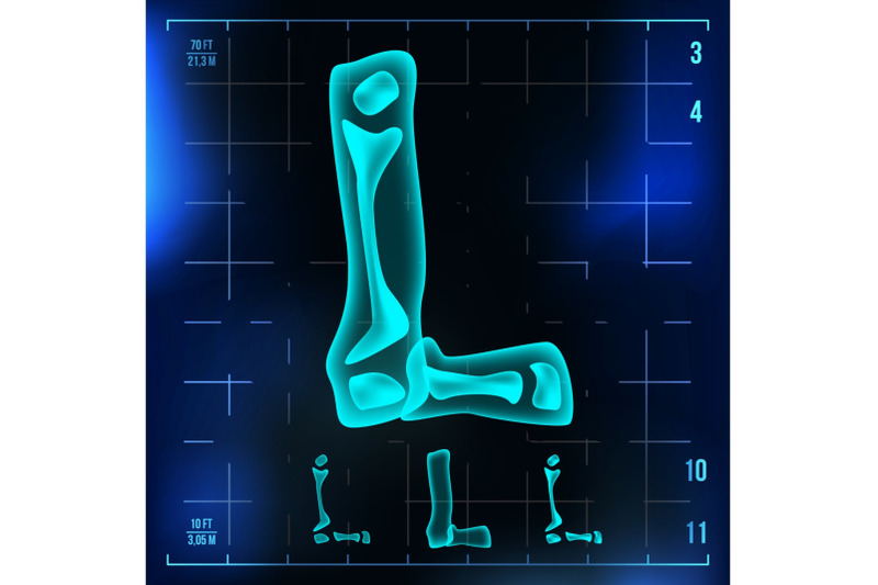 l-letter-vector-capital-digit-roentgen-x-ray-font-light-sign-medical-radiology-neon-scan-effect-alphabet-3d-blue-light-digit-with-bone-medical-hospital-futuristic-horror-style-illustration