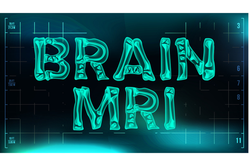 brain-mri-banner-vector-medical-background-transparent-roentgen-x-ray-text-with-bones-radiology-3d-scan-medical-health-typography-futuristic-technology-illustration