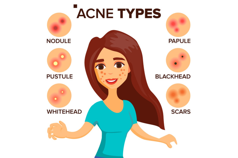 acne-types-vector-girl-with-acne-skin-care-treatment-healthy-nodule-whitehead-isolated-flat-cartoon-character-illustration