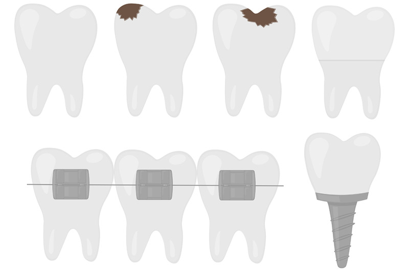 dentist-dentistry-dental-treatment-vector