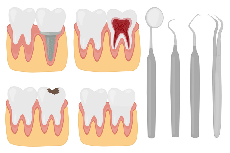 dentist-dentistry-dental-treatment-vector