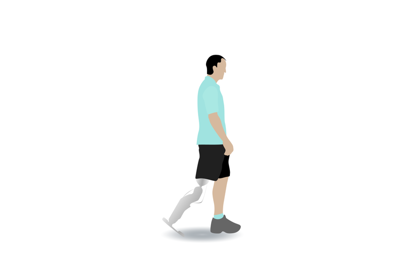 man-with-leg-prothesis-walking-isolated-on-white-background