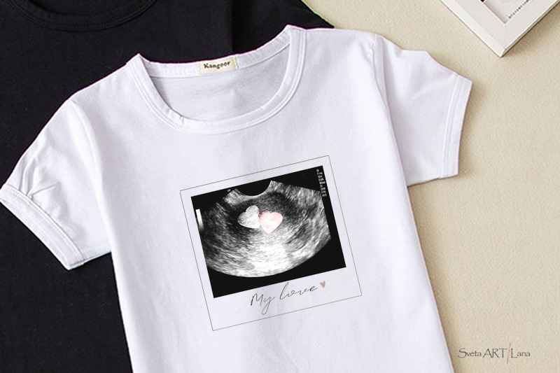 sublimation-png-ultrasound-photos