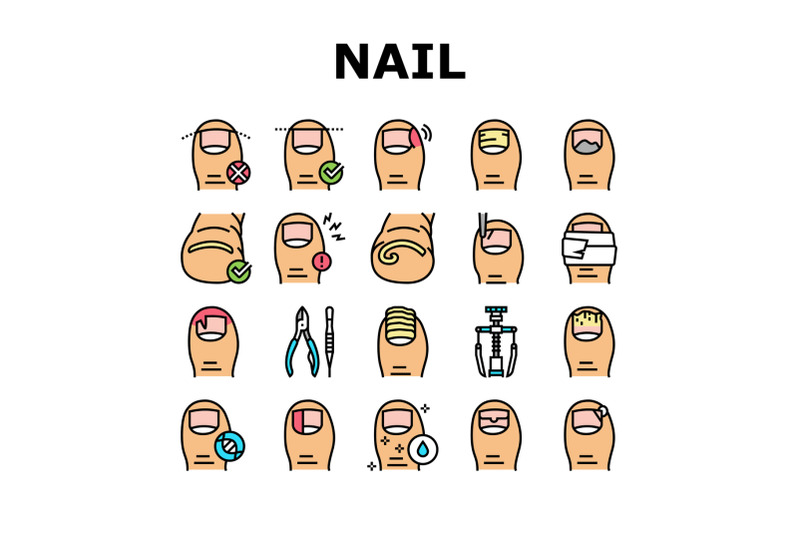 ingrown-nail-disease-collection-icons-set-vector