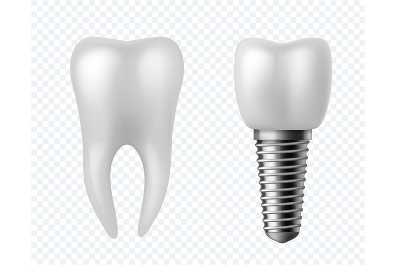 teeth-and-implant-dental-surgery-human-white-enamel-tooth-crown-dentu