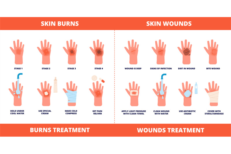 skin-first-aid-burns-treatment-wounds-and-trauma-symptoms-degree-bu
