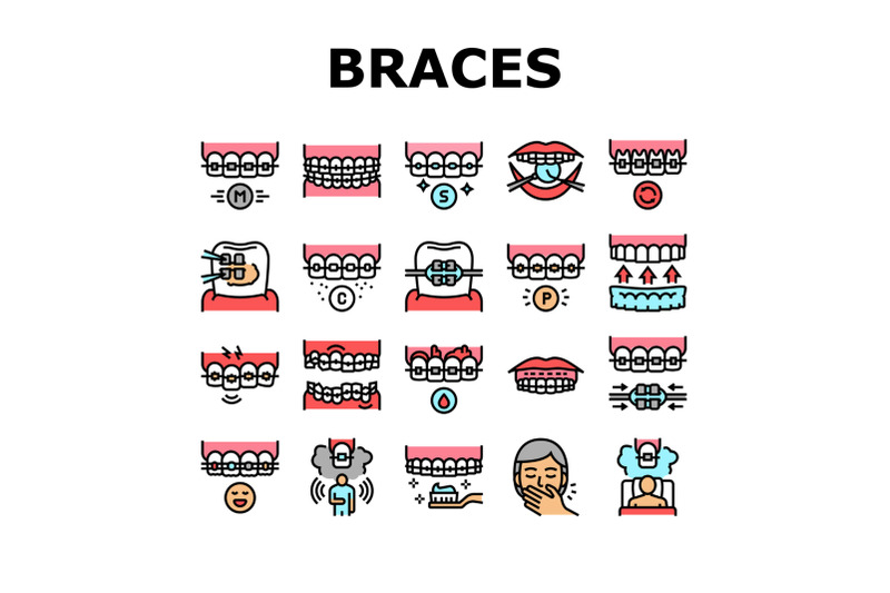 tooth-braces-accessory-collection-icons-set-vector