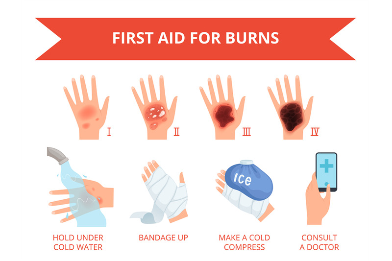 burn-skin-first-treatment-human-hand-fire-or-chemical-destruction-inj