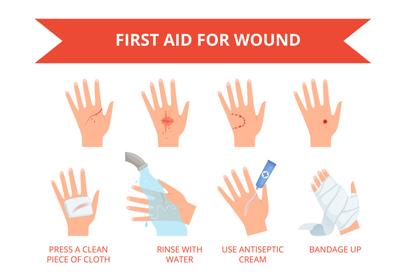 wound-skin-treatment-first-emergency-help-for-human-hand-trauma-injur