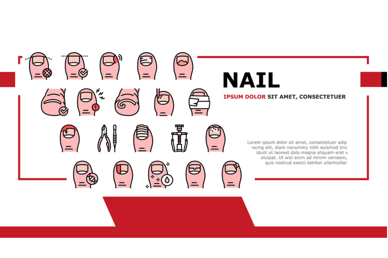 ingrown-nail-disease-landing-header-vector