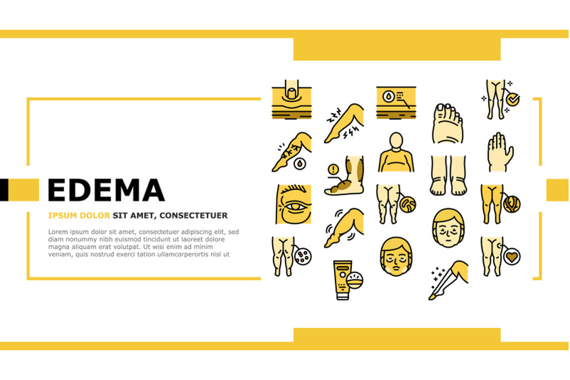 edema-disease-symptom-landing-header-vector