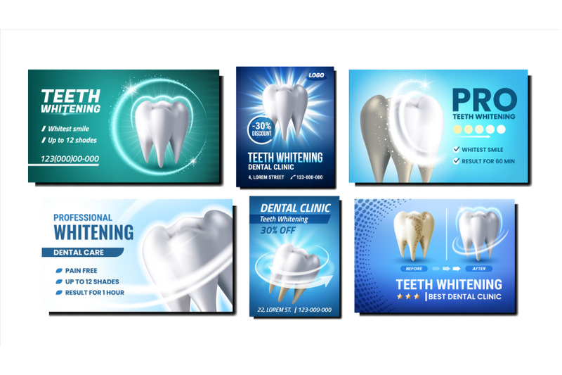 teeth-whitening-promotional-posters-set-vector
