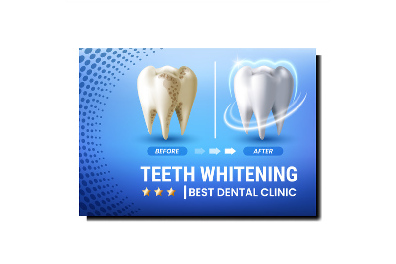 teeth-whitening-creative-promotional-poster-vector