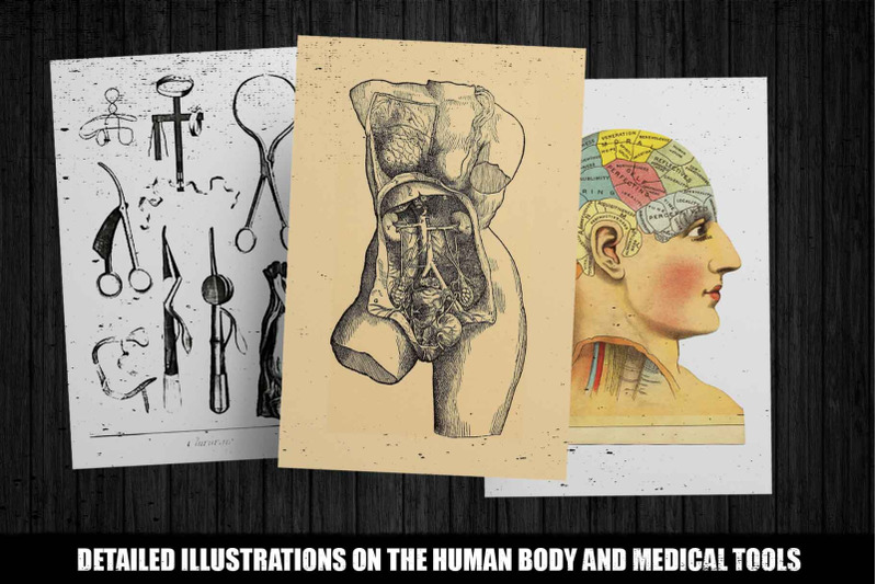 100-vintage-medical-illustrations