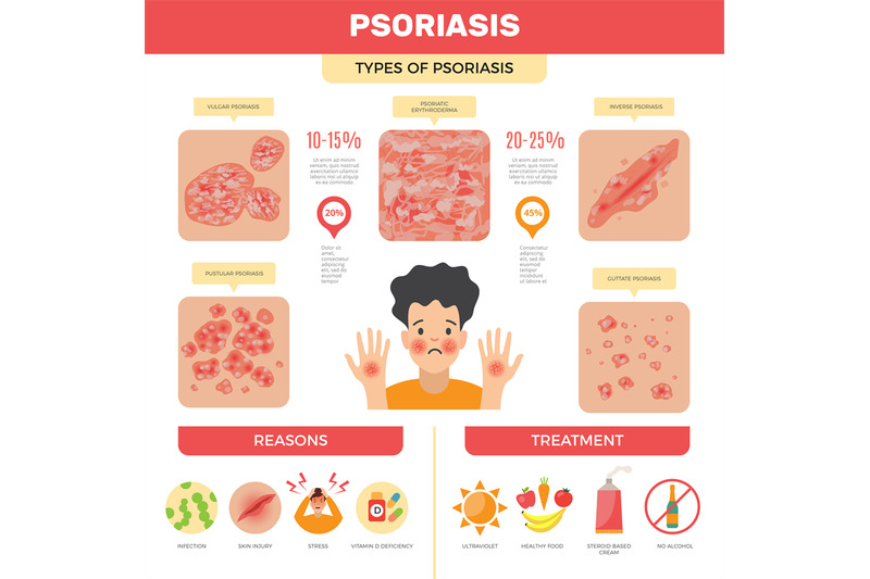 psoriasis-infographic-human-skin-infection-psoriasis-diagnosis-vector