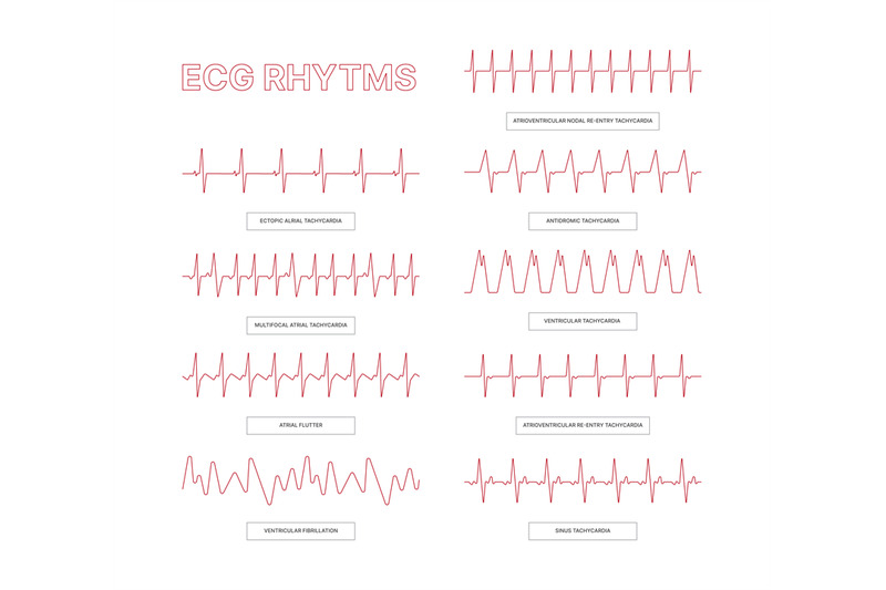 ecg-templates-medical-infographic-lines-heart-arrhythmia-health-conce