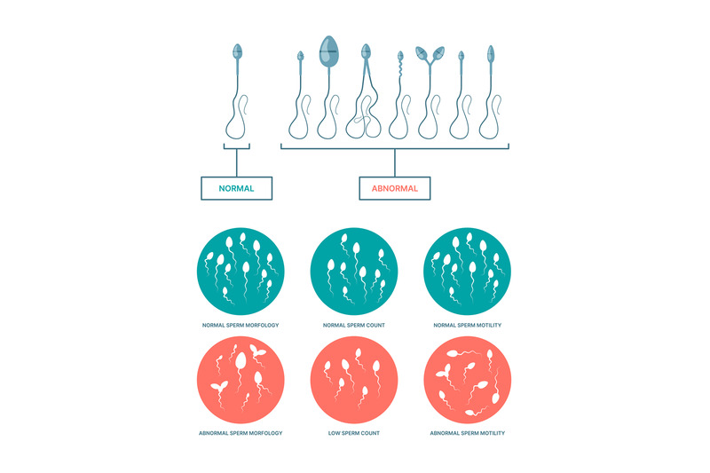 spermogram-medical-infographic-with-healthy-and-damaged-spermatozoa-b