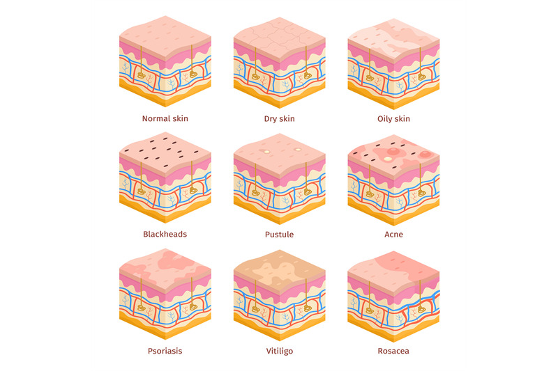 3d-human-skin-types-cross-section-layers-dry-oily-and-normal-epiderm