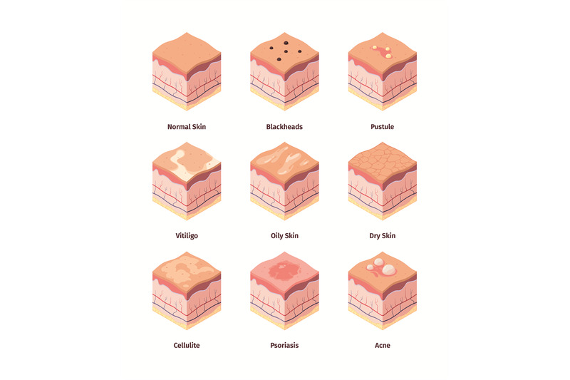 type-of-skin-dermis-structure-human-body-cross-layers-biological-illu