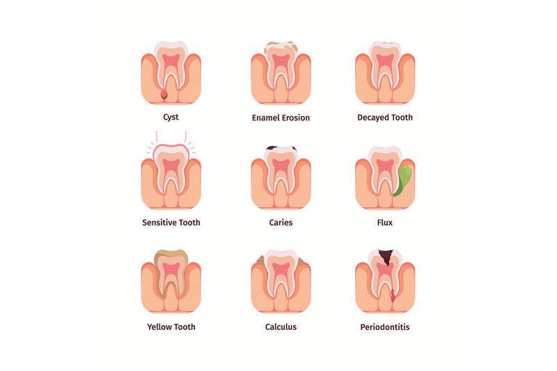 dental-problems-different-oral-bacteria-teeth-drawings-common-bad-fil