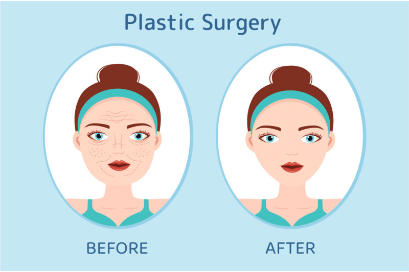 10-plastic-surgery-flat-illustration