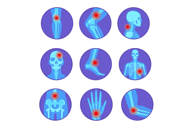 orthopedic-joint-diseases-rheumatoid-pain-bone-knee-hand-elbow-arthri