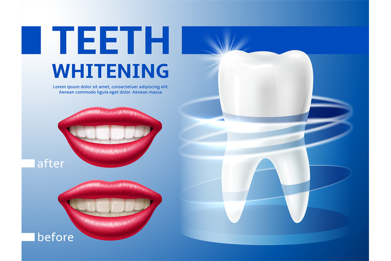 teeth-whitening-poster-realistic-3d-smiling-lips-with-perfect-result