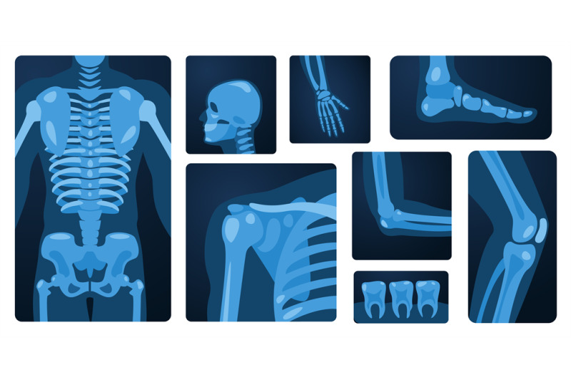 x-ray-body-parts-human-skeleton-knee-arm-chest-wrist-foot-medical-x