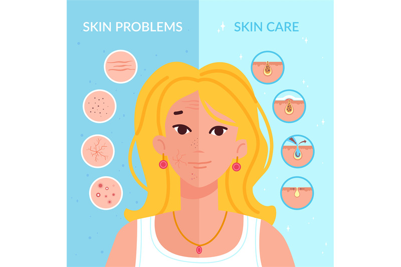 skin-problems-solution-home-skincare-treatment-procedures-teenager-f