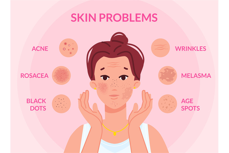 types-skin-problems-woman-face-with-skins-troubles-melasma-pimple-bl