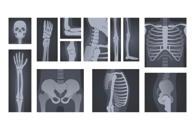 x-ray-shots-human-body-radiology-of-head-skull-hand-bones-spine-and
