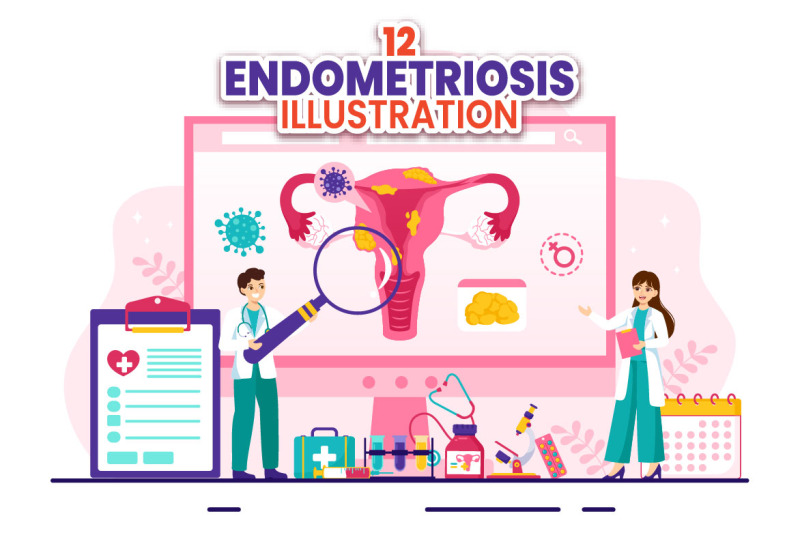 12-endometriosis-illustration