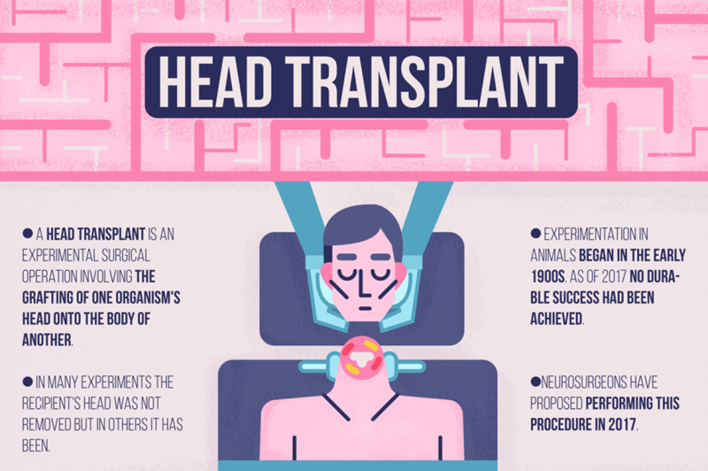 human-head-transplant-infographics