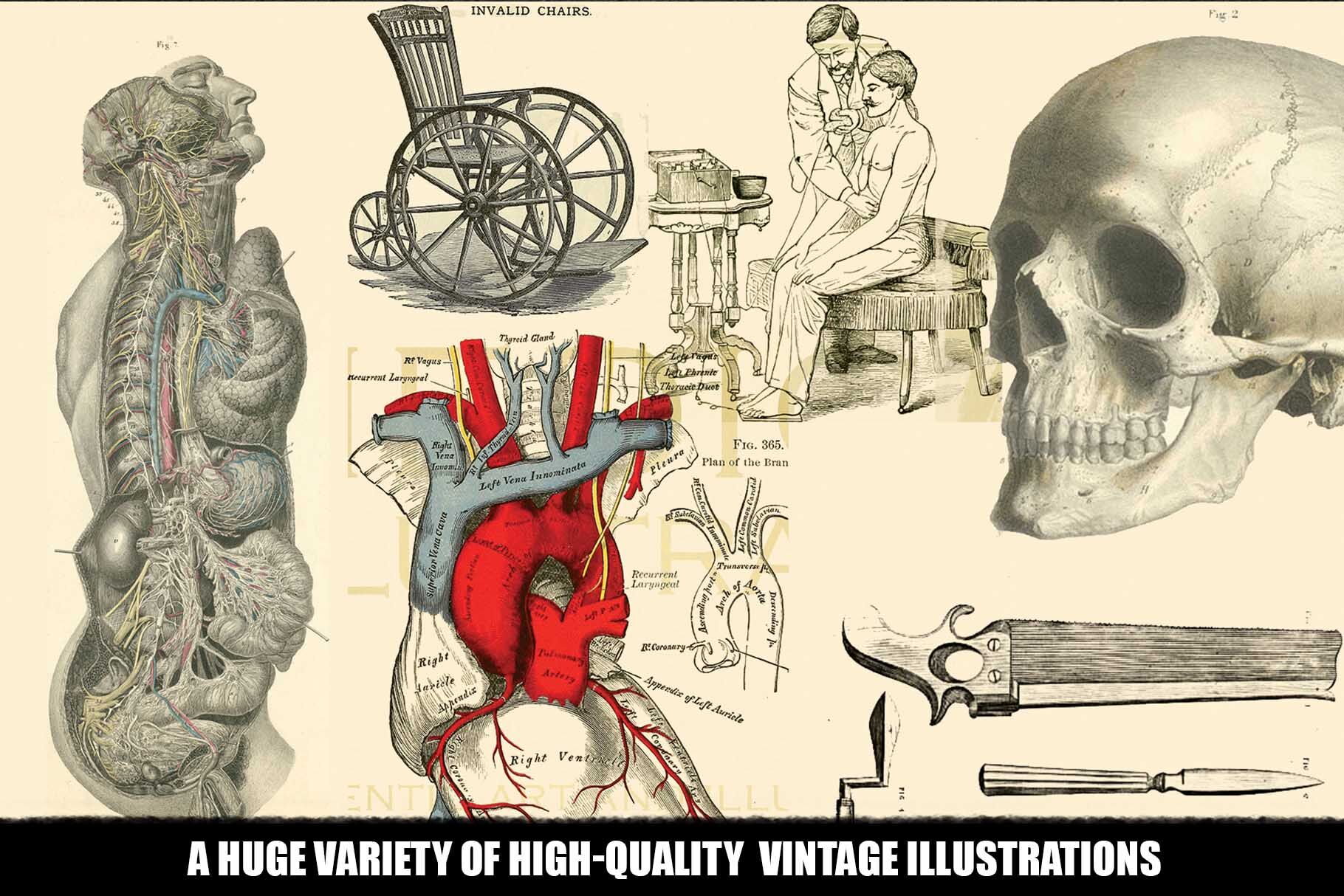 free download vintage medical illustrations