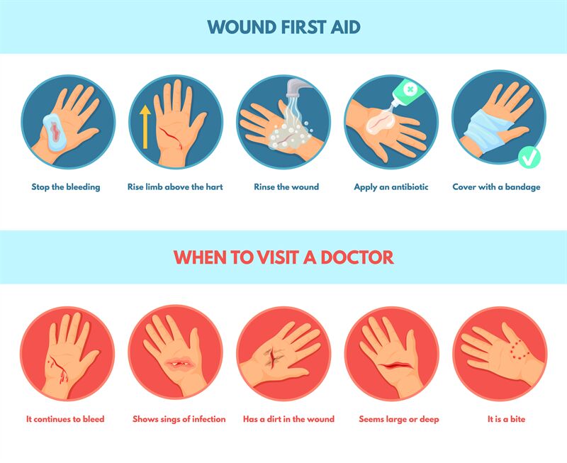 Aid skin wound. First aids stop bleeding, infographic types emergency ...